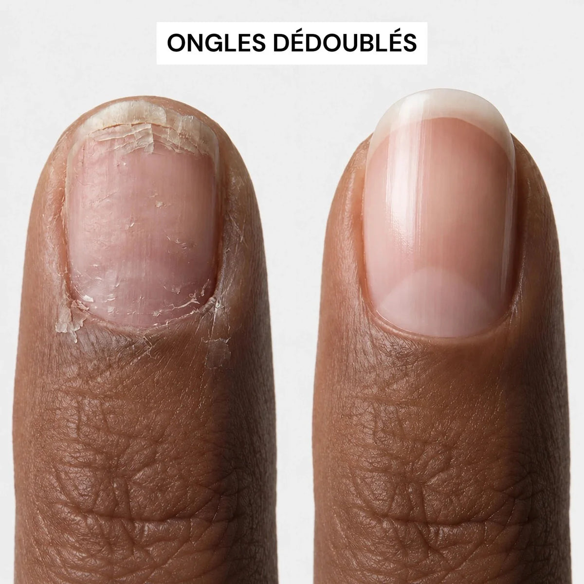 Sérum Croissance & Renforcement des ongles