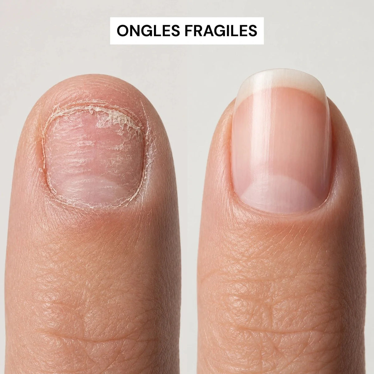 Sérum Croissance & Renforcement des ongles